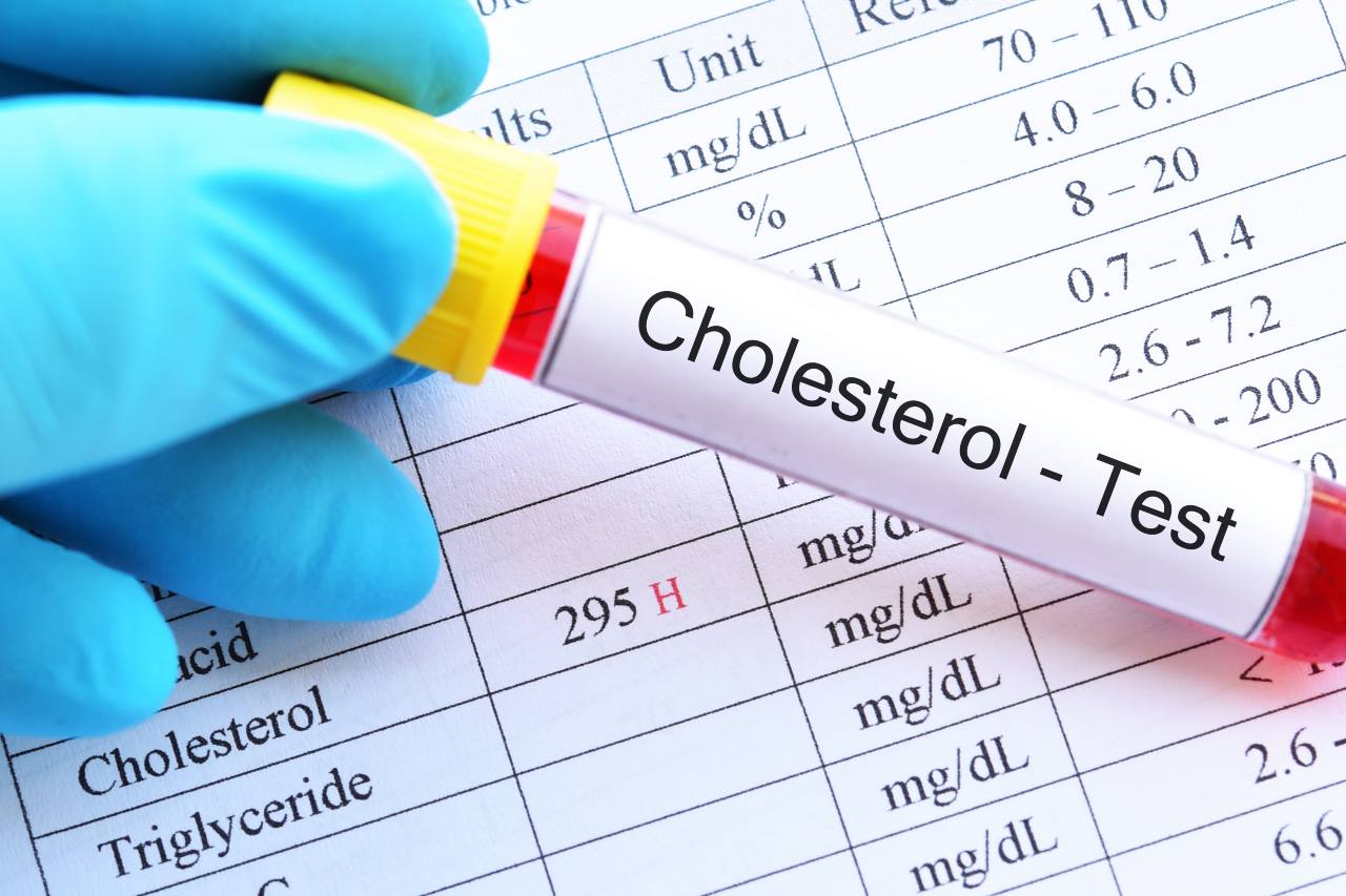 Cholesterol